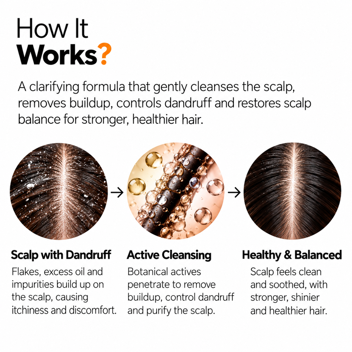 The Origin Lab.ROVÉA Rosemary Anti-Dandruff Shampoo 200ml