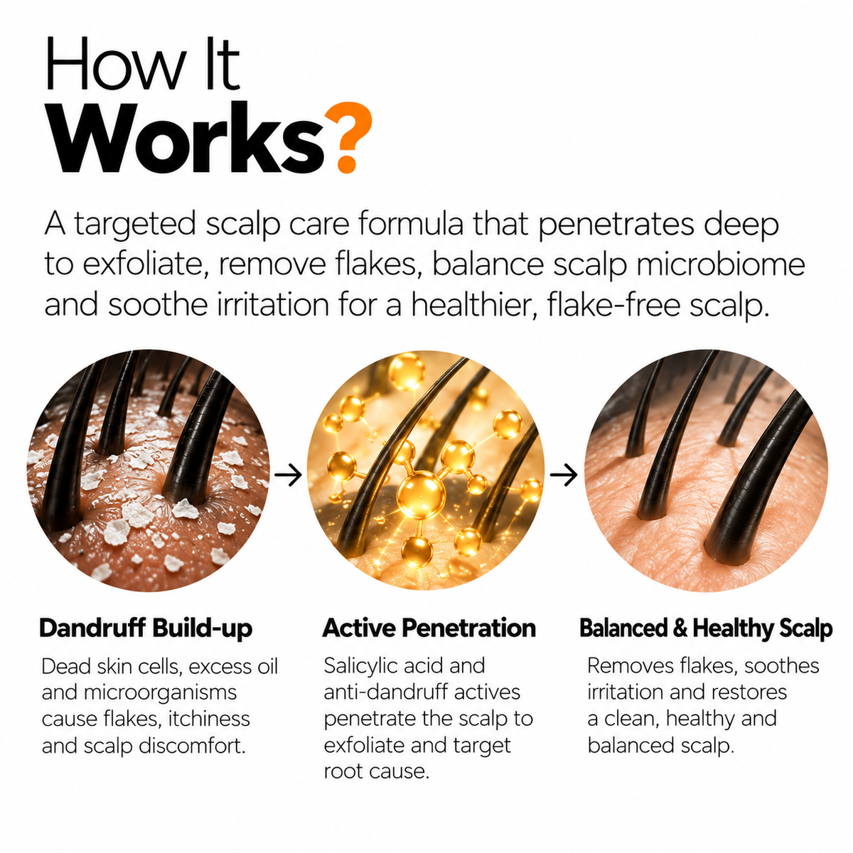 The Origin Lab. Anti-Dandruff Control Serum – 2% Salicylic Acid + 0.5% Piroctone Olamine
