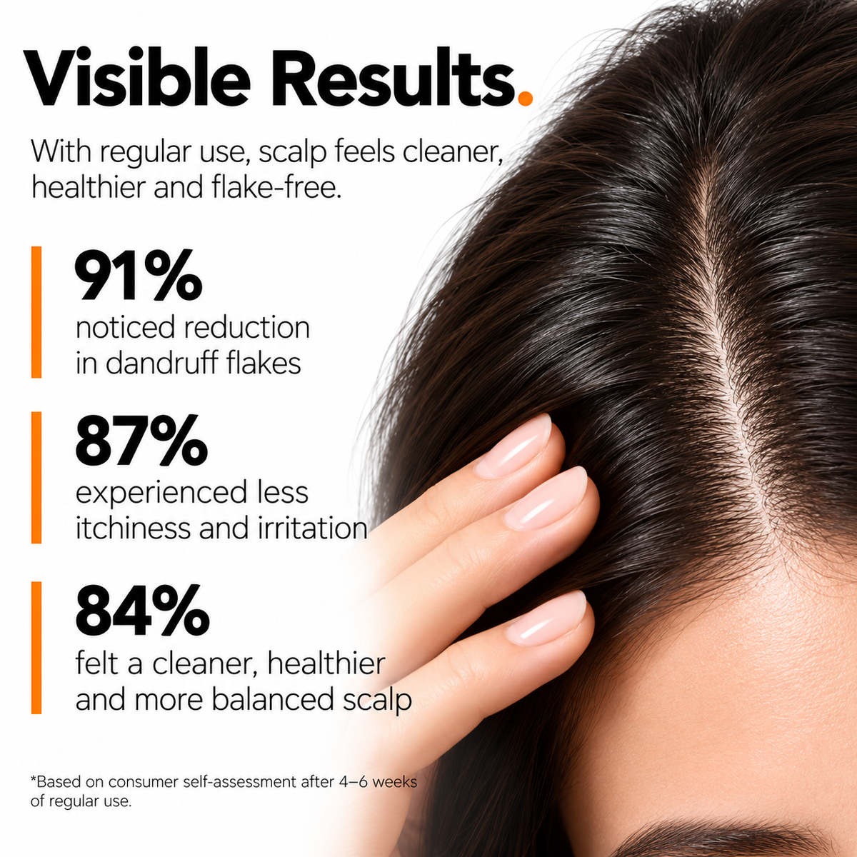 The Origin Lab. Anti-Dandruff Control Serum – 2% Salicylic Acid + 0.5% Piroctone Olamine