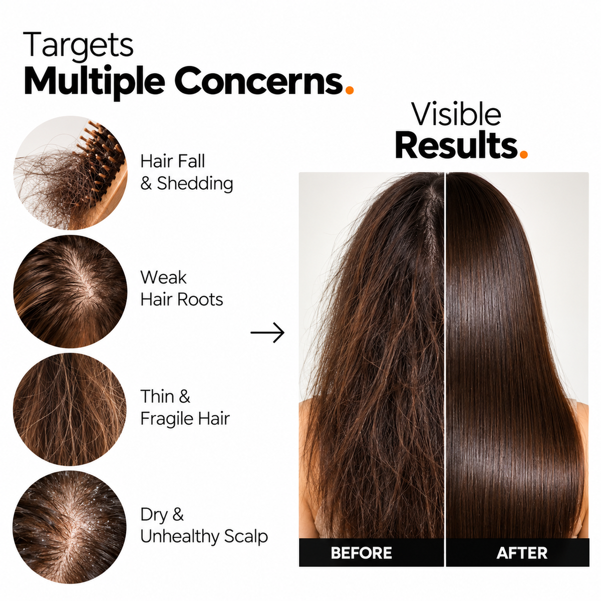 Onion Root Elixir Hair Growth Oil with Onion Extract & Caffeine Complex – 10 ml
