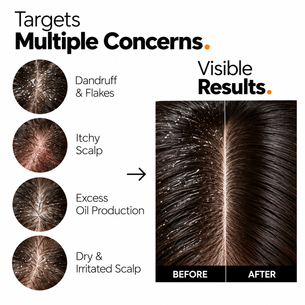 The Origin Lab. Anti-Dandruff Control Serum – 2% Salicylic Acid + 0.5% Piroctone Olamine