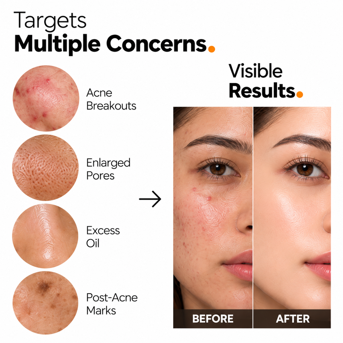The Origin Lab 2% Salicylic Acid Face Serum – 15ml